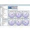 E-MNG: View sensor status in a bar graph or circular gauge.